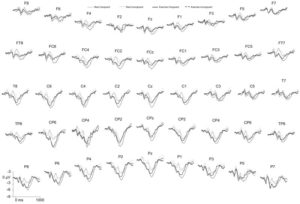 Many graphs showing electroencephalography results at the 3rd positivity.